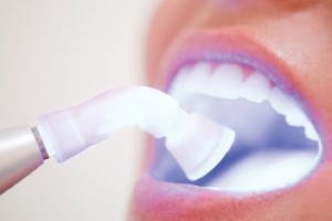 No dentista Clareamento dos dentes