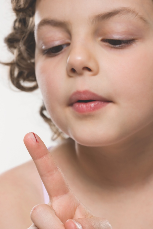 Why do paper cuts hurt so much? How It Works