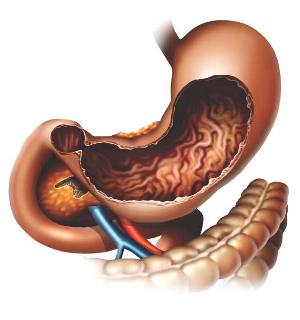 Inside the stomach – How It Works