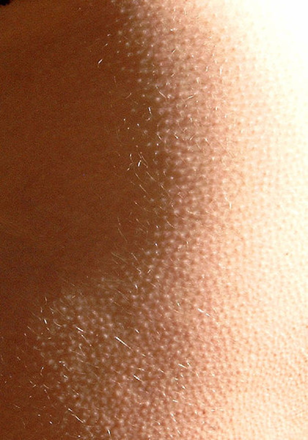 Why do we get goose bumps? How It Works Magazine