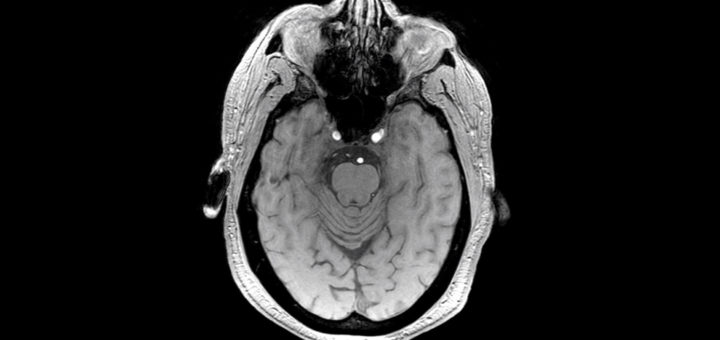 Breakthrough Brain scan photo.  (photo credit: GE)