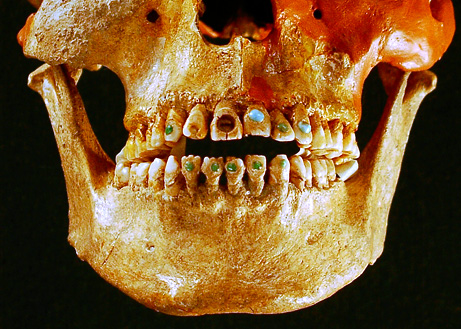5 gruesome facts about ancient dentistry