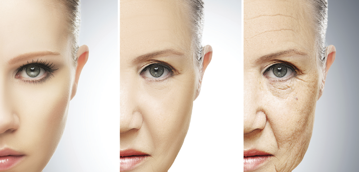 how are wrinkles formed