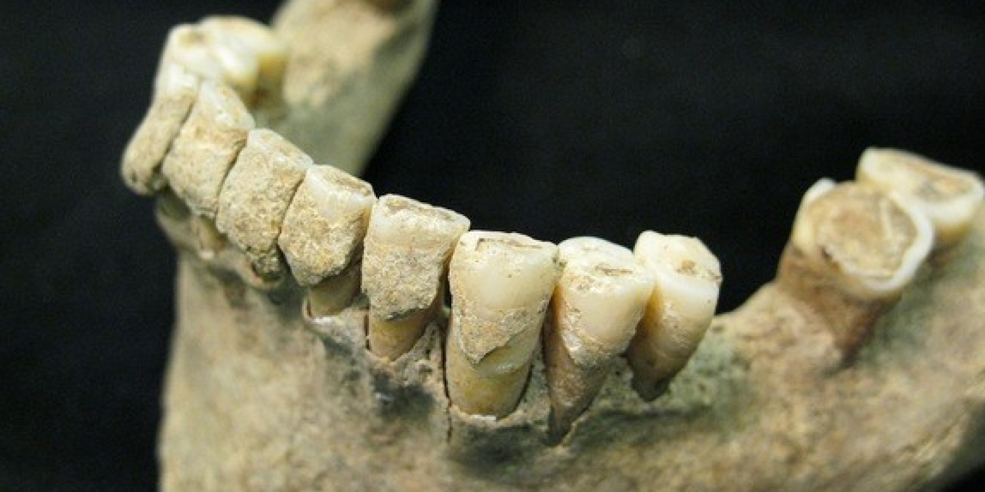 5 gruesome facts about ancient dentistry How It Works