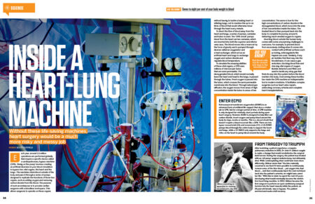 hiw220_lung